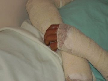LESION (18)  IMAGENES FOTOS
